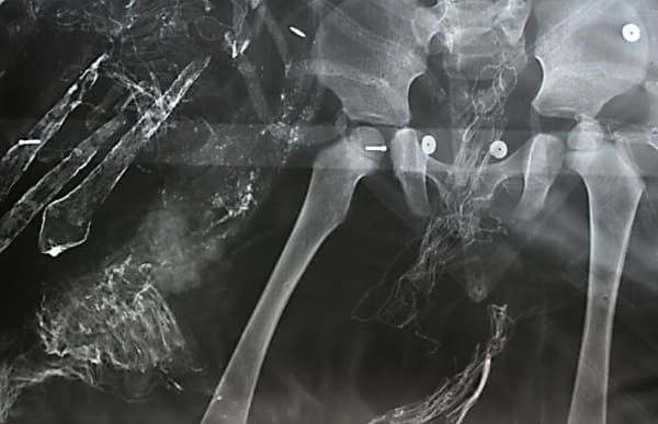Vista anterior de la pelvis de momia 8.